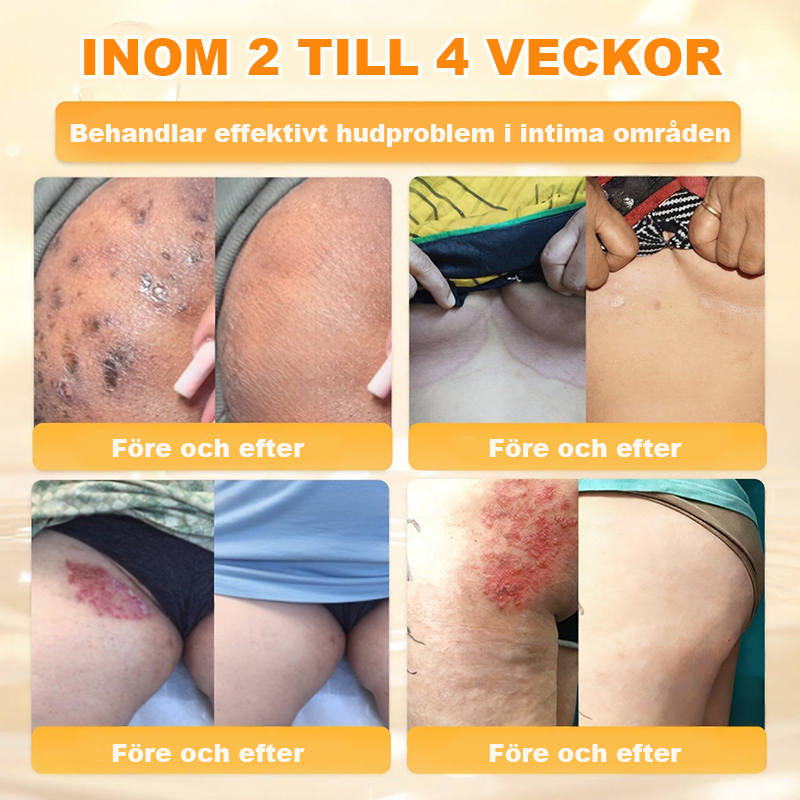 Tillverkad och skickad från Sverige💧 AWZLOVE® Heltäckande Biodjurskräm🔥 SISTA DAGEN – 80 % RABATT! 💧