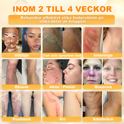 Tillverkad och skickad från Sverige💧 AWZLOVE® Heltäckande Biodjurskräm🔥 SISTA DAGEN – 80 % RABATT! 💧