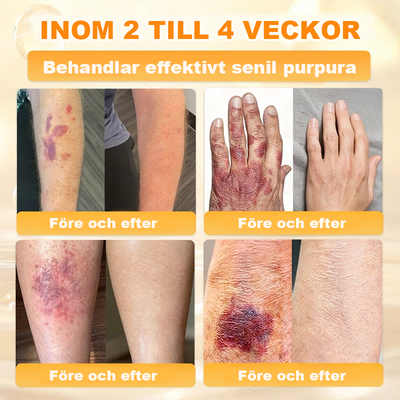 Tillverkad och skickad från Sverige💧 AWZLOVE® Heltäckande Biodjurskräm🔥 SISTA DAGEN – 80 % RABATT! 💧