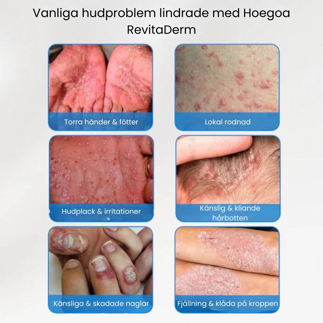 Hoegoa RevitaDerm